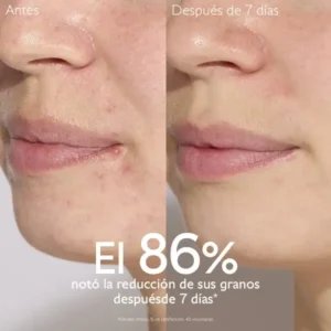 vinopure serum salicylico anti-imperfecciones
