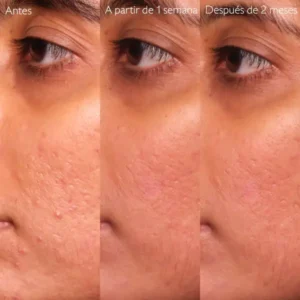 vinopure serum salicylico anti-imperfecciones