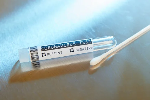 test-rapidos-covid-19