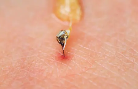 aguijón-picadura-de abeja